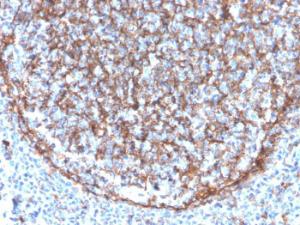 Immunohistochemical analysis of formalin-fixed, paraffin-embedded human tonsil using Anti-CD11b Antibody [ITGAM/3340]