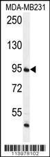 Anti-FTSJ3 Rabbit Polyclonal Antibody (PE (Phycoerythrin))