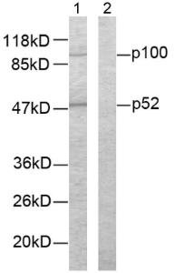 Western blot analysis of lysates from ovary cancer cells using Anti-NF kappa B p100 / p52 Antibody. The right hand lane represents a negative control, where the antibody is blocked by the immunising peptide.