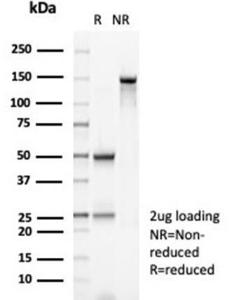 SDS-PAGE analysis of Anti-MSH2 Antibody [MSH2/6852] under non-reduced and reduced conditions; showing intact IgG and intact heavy and light chains, respectively. SDS-PAGE analysis confirms the integrity and purity of the antibody