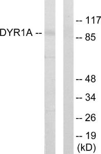 Western blot analysis of lysates from HepG2 cells using Anti-DYR1A Antibody. The right hand lane represents a negative control, where the Antibody is blocked by the immunising peptide