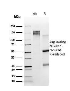 SDS-PAGE analysis of Anti-TRIM27 Antibody [PCRP-TRIM27-1B3] under non-reduced and reduced conditions; showing intact IgG and intact heavy and light chains, respectively. SDS-PAGE analysis confirms the integrity and purity of the antibody.