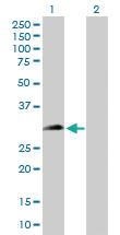 Anti-CHMP1A Mouse Polyclonal Antibody