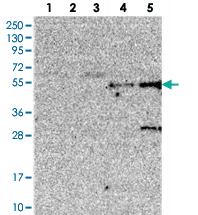 Anti-TMEM39B Rabbit Polyclonal Antibody