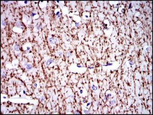 Anti-MBP Mouse Monoclonal Antibody [clone: 2H9]