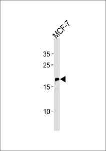 Anti-NRAS Rabbit Polyclonal Antibody