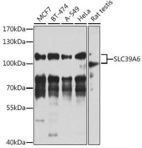 Antibody anti-SLC39A6 100 µl