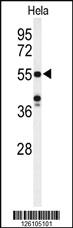 Anti-POTEH Rabbit Polyclonal Antibody