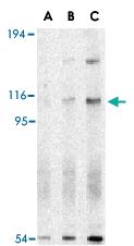 Anti-ERN1 Rabbit Polyclonal Antibody