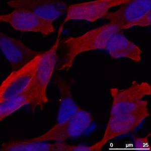 Immunofluorescence staining of alpha synuclein in cultured cells using Sheep antibody to alpha synuclein, catalog number BSENS-078-50 and fluorescent-labelled secondary antibody. Image courtesy of Dr Wei-Ping Gai, Flinders University of South Australia.