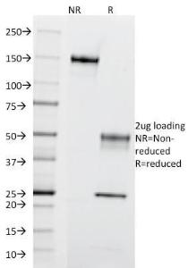 SDS-PAGE analysis of Anti-CD195 Antibody [12D1] under non-reduced and reduced conditions; showing intact IgG and intact heavy and light chains, respectively. SDS-PAGE analysis confirms the integrity and purity of the antibody