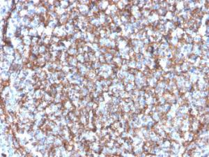 Immunohistochemical analysis of formalin-fixed, paraffin-embedded human tonsil using Anti-CD11b Antibody [ITGAM/3340]