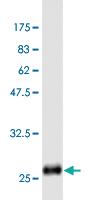 Anti-GST tag Monoclonal Antibody