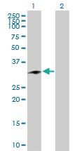 Anti-CHMP1A Rabbit Polyclonal Antibody