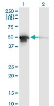 Anti-PDIA6 Mouse Monoclonal Antibody [clone: 3B4]