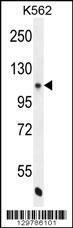 Anti-NOS3 Rabbit Polyclonal Antibody (AP (Alkaline Phosphatase))