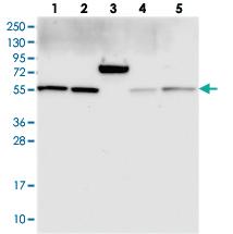 Anti-GADL1 Rabbit Polyclonal Antibody