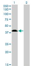 Anti-SGMS2 Mouse Monoclonal Antibody [clone: 7D10]