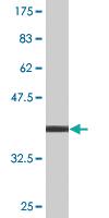 Anti-NCBP1 Mouse Monoclonal Antibody [clone: 1E9]