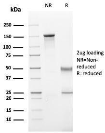 SDS-PAGE analysis of Anti-CD11b Antibody [ITGAM/3340] under non-reduced and reduced conditions; showing intact IgG and intact heavy and light chains, respectively. SDS-PAGE analysis confirms the integrity and purity of the antibody