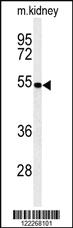 Anti-PMPCB Rabbit Polyclonal Antibody