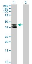 Anti-MRPS9 Mouse Polyclonal Antibody