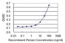 Anti-MRPS21 Mouse Monoclonal Antibody [clone: 1C5]