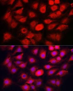 Anti-Caspase-1 antibody