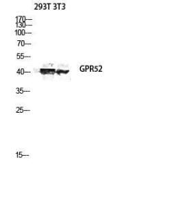 Antibody anti-GPR52 100 µg