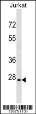 Anti-ANP32B Rabbit Polyclonal Antibody