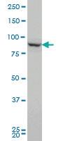 Anti-PCSK1 Mouse Monoclonal Antibody [clone: 3D2]