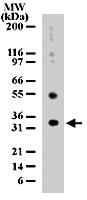 Anti-UNG Rabbit Polyclonal Antibody