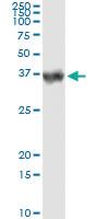 Anti-CA1 Antibody Pair