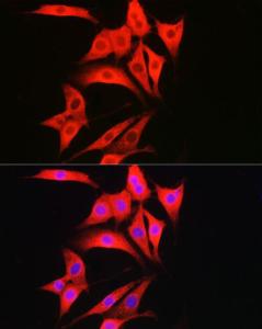 Anti-Caspase-1 antibody