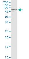 Anti-PCSK1 Mouse Monoclonal Antibody [clone: 3D2]