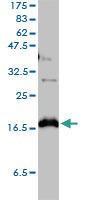 Anti-CLDN1 Mouse monoclonal antibody [clone: 1C5-D9]