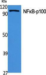 Western blot analysis of various cells using Anti-NF kappa B p100 / p52 Antibody