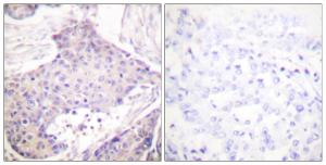 Anti-CARD6 antibody