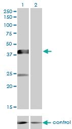 Anti-SGMS2 Mouse Monoclonal Antibody [clone: 7D10]