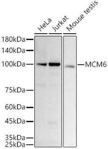 Anti-MCM6 Rabbit Monoclonal Antibody [clone: ARC3057]