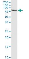 Anti-PCSK1 Mouse Monoclonal Antibody [clone: 3D2]