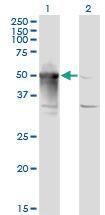 Anti-ARMC6 Mouse Monoclonal Antibody [clone: 2H8]