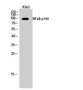 Western blot analysis of K562 cells using Anti-NF kappa B p100 / p52 Antibody