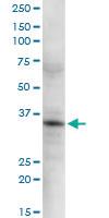 Anti-GSTO2 Rabbit Polyclonal Antibody