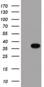 Anti-MGLL Mouse Monoclonal Antibody [clone: OTI1B1]