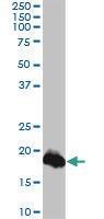 Anti-CLDN1 Mouse monoclonal antibody [clone: 1C5-D9]