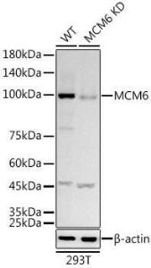 Anti-MCM6 Rabbit Monoclonal Antibody [clone: ARC3057]