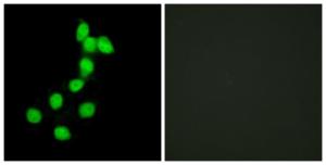 Immunofluorescence analysis of HepG2 cells using Anti-DYR1A Antibody. The right hand panel represents a negative control, where the Antibody was pre-incubated with the immunising peptide