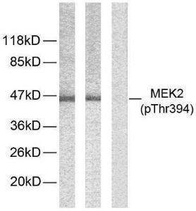 Western blot analysis of lysates from ovary cancer using Anti-MEK2 (phospho Thr394) Antibody. The right hand lane represents a negative control, where the antibody is blocked by the immunising peptide.