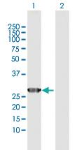 Anti-GSTO2 Rabbit Polyclonal Antibody